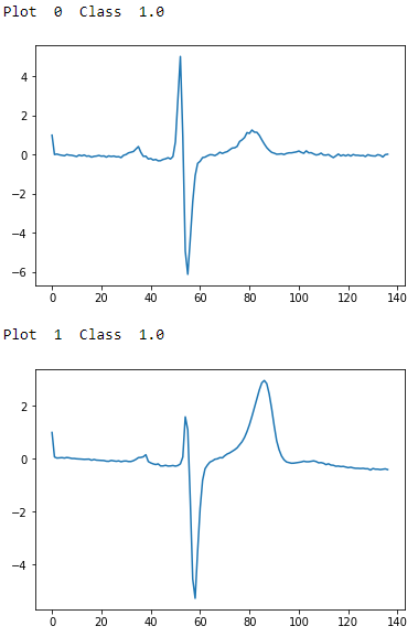 ECG Five Days Class 1.0 - First Two Examples