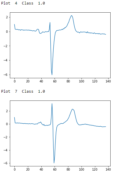 ECG Five Days Class 1.0 - Second Two Examples
