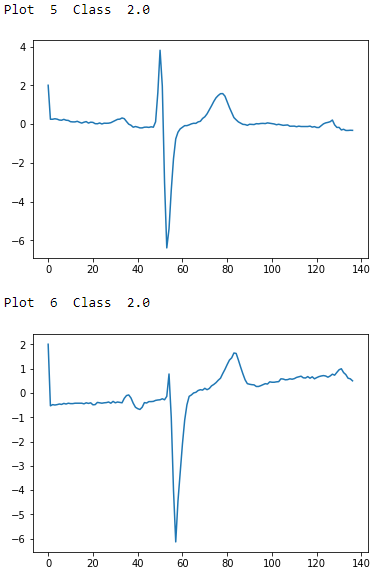 ECG Five Days Class 2.0 - Second Two Examples